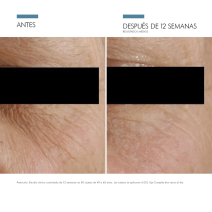 SkinCeuticals A.G.E. Eye Complex 15ml