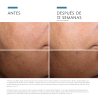 Skinceuticals Discoloration Serum 30ml