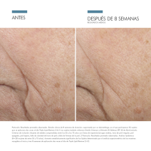SkinCeuticals Triple Lipid Restore 2:4:2 48ml