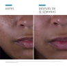 Skinceuticals Silymarin CF 30ml