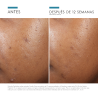 Skinceuticals Phyto A+ Brightening Treatment 30 ml